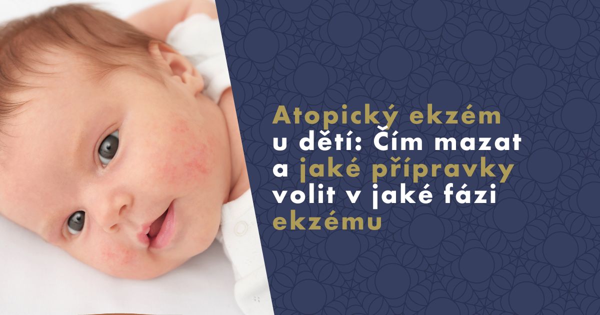 atopicky-ekzem-u-deti
